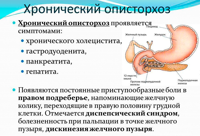 Анизакидоз: симптомы и лечение