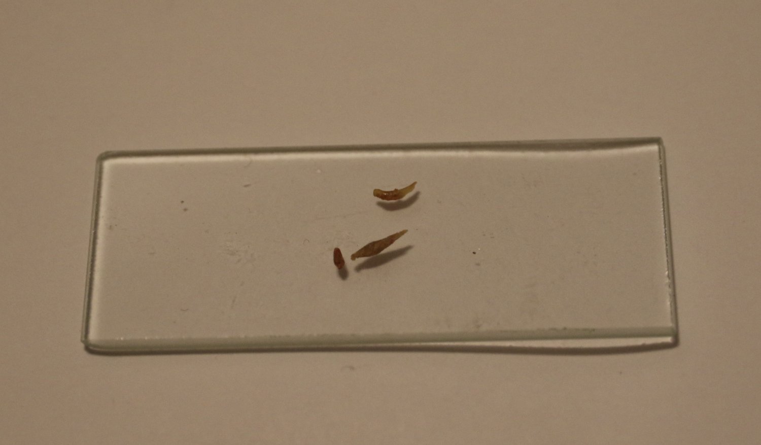 описторхоз барнаул